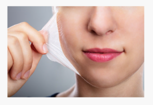 Chemical Peel